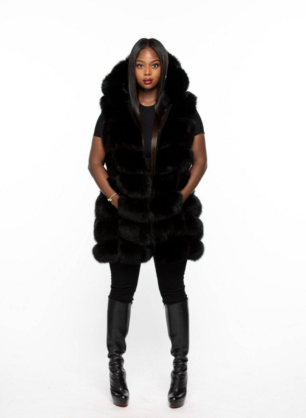 Shirley Fox Fur Coat with Detachable Hood and Sleeves